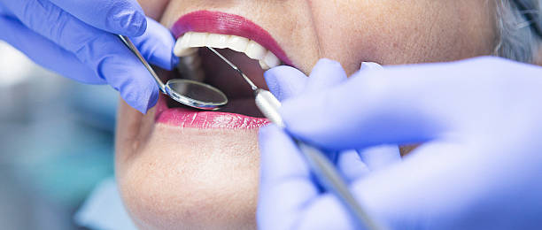 Best Emergency Root Canal Therapy in Perkasie, PA