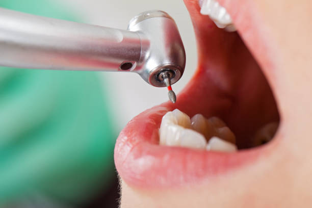 Best Emergency Denture Repair in Perkasie, PA